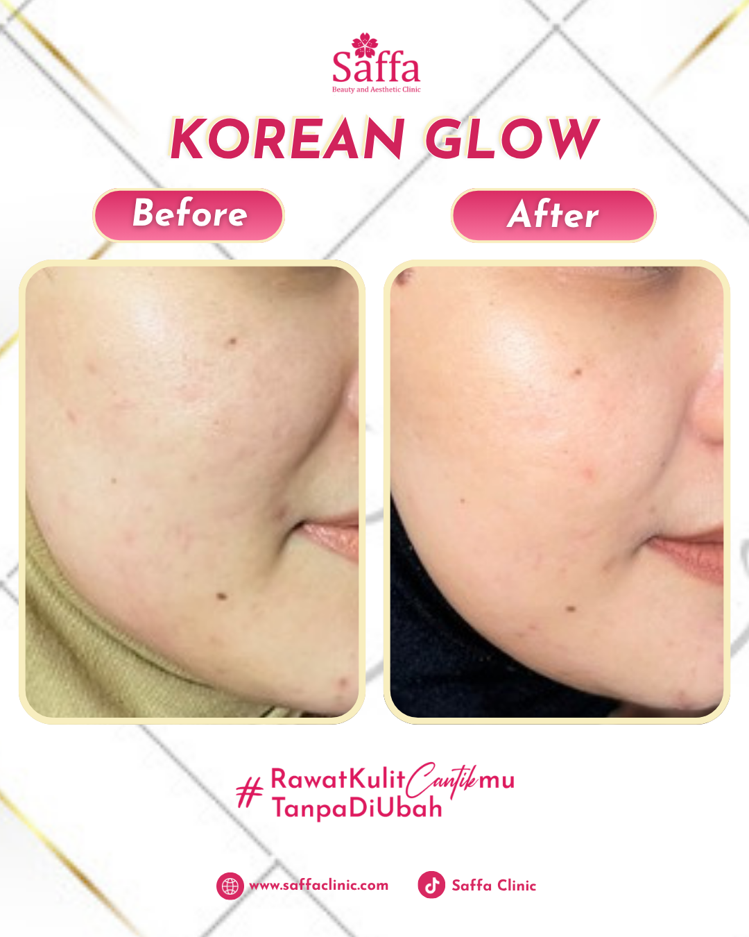Before After Korean Glow