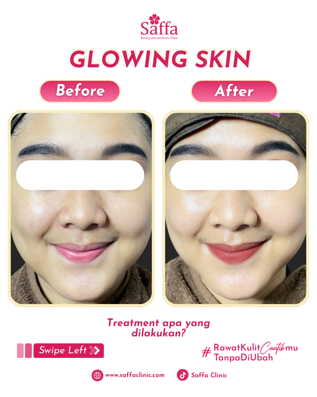 Before After Korean Glow